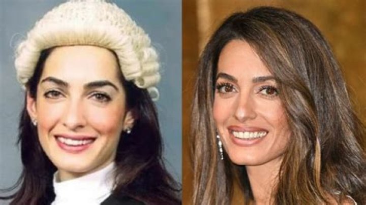 Amal Clooney's Transformative Plastic Surgery Journey: Uncovering The Truth